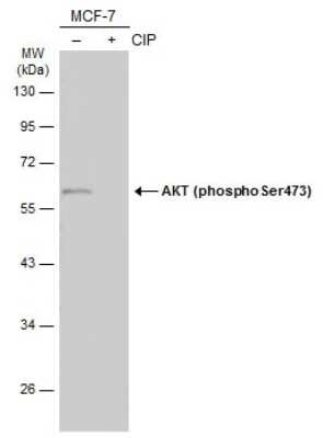 Western Blot: AKT [p Ser473] Antibody [NBP3-13120]